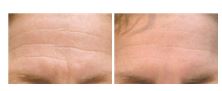 La verdadera causa de las arrugas es la gesticulación. Si reduces los gestos, reduces arrugas.