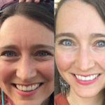 El antes y el después de aplicar los parches anti arruga de Frownies