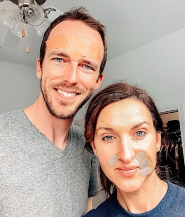 Hombres y mujeres satisfechos con los resultados de los parches faciales anti arrugas de Frownies
